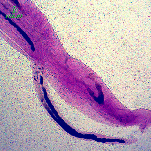 湖北日本血吸虫雌雄合抱装片