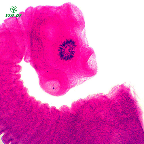 湖北医学蠕虫绦虫装片