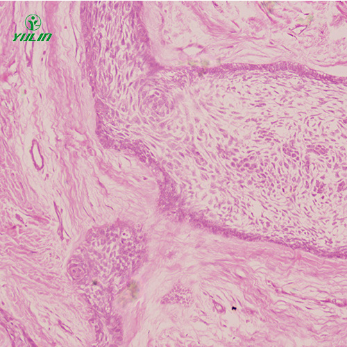 湖北人口腔病理标本片