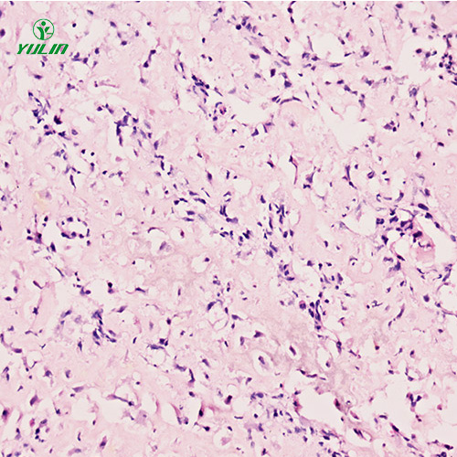 湖北人肌肉骨骼系统疾病标本片