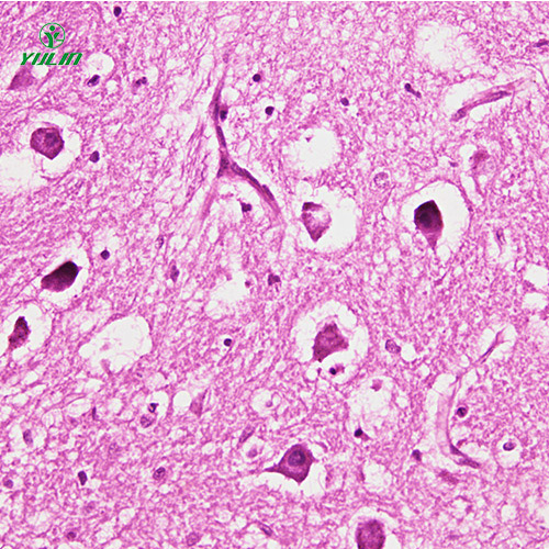 湖北人神经系统疾病标本片