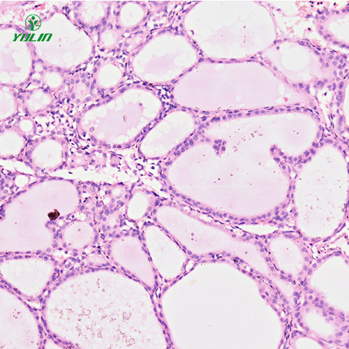 湖北人内分泌系统疾病标本片
