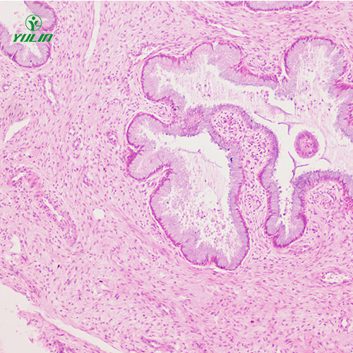 湖北人泌尿生殖系统疾病标本片