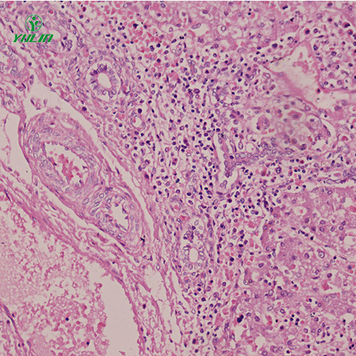 湖北人消化系统疾病标本片