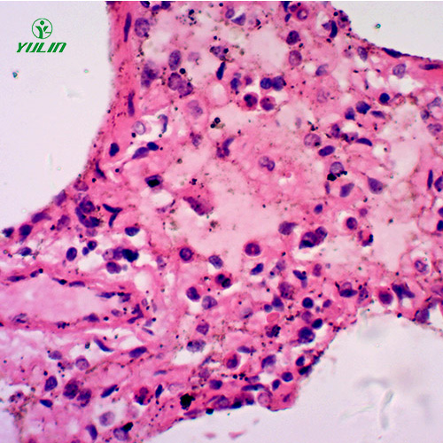 湖北人呼吸系统疾病标本片