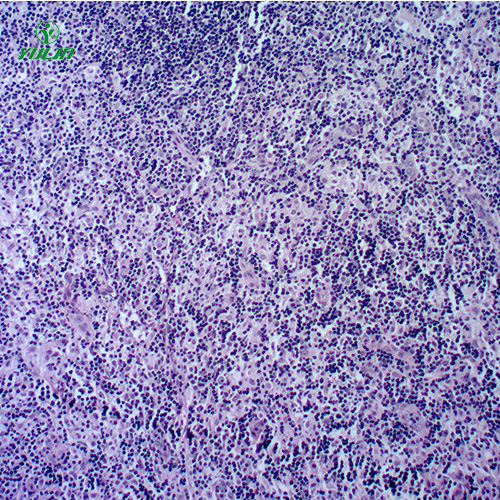 湖北人体免疫性疾病切片