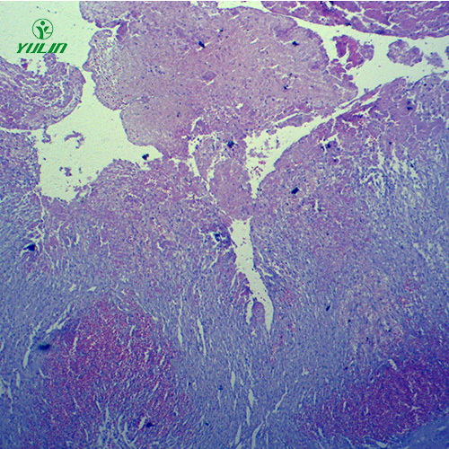 湖北人体局部血液循环障碍病理玻片