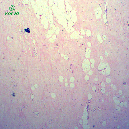 湖北人体细胞组织损伤病理切片