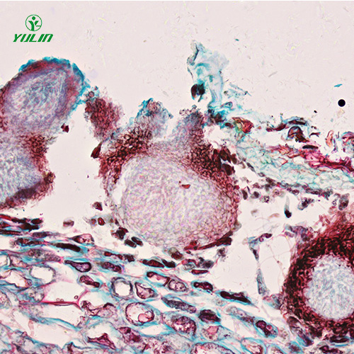 湖北水果病害标本片