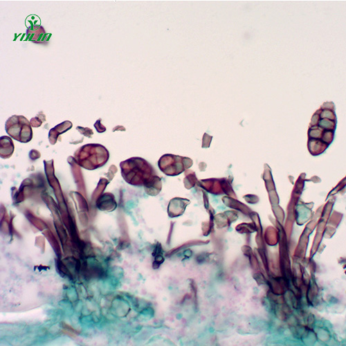 湖北茄科植物病害玻片