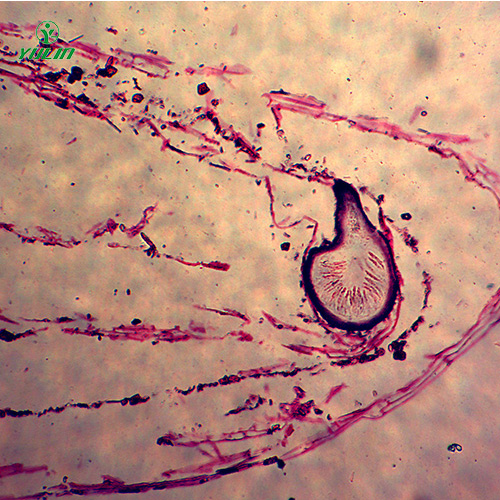 湖北子囊菌植物病理玻片