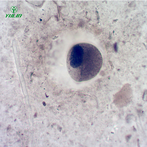 湖北医学寄生虫纤毛虫玻片