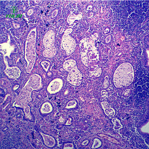 湖北炎症病理玻片